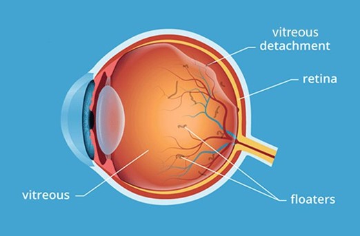 What’s Comprehensive Eye Care? New Retina and Diabetic Exams Live on Loh Ophthalmology